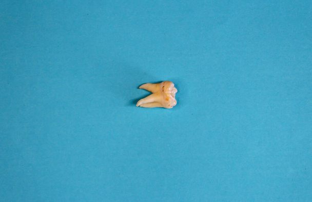 dente sabedoria extraída no fundo azul, de perto - Foto, Imagem