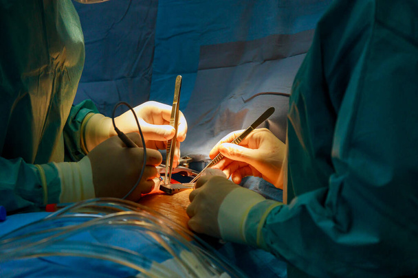 Durante a cirurgia médico fechar as mãos de coração aberto de cirurgiões - Foto, Imagem