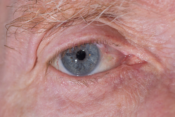 Eye examination - Photo, Image