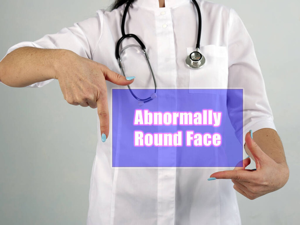 Orvosi fogalom jelentése Abnormálisan kerek arc kifejezéssel a darab papír - Fotó, kép