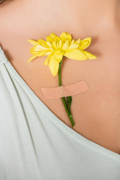vista recortada de yeso con flor amarilla en el cuerpo de la mujer - Foto, Imagen