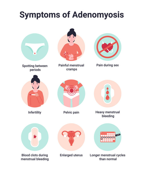 Установите симптомы аденомиоза, интерны эндометриоза или аденомиометрита. Плоская векторная карикатура. - Вектор,изображение