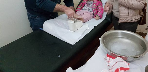 σπασμένα πόδια του μωρού παιδί στο doctror κατά την εξέταση, γύψο στο πόδι - Φωτογραφία, εικόνα
