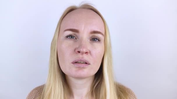 Een vrouw onderzoekt de droge huid op haar lippen. Schillen, grof worden, ongemak, gevoeligheid van de huid. Patiënt bij de benoeming van een dermatoloog of cosmetoloog. Close-up van stukken droge huid - Video