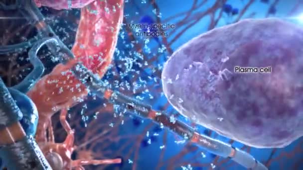 Mnohočetný myelom je typ rakoviny, který se skládá z typu bílých krvinek nazývaných plazmatické buňky. - Záběry, video