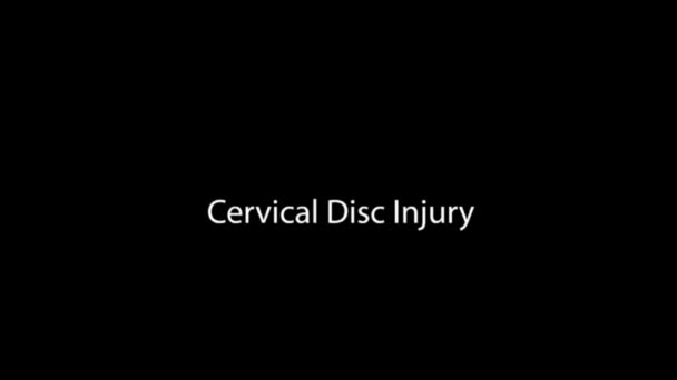 Sistema scheletrico umano, disco cervicale - Filmati, video