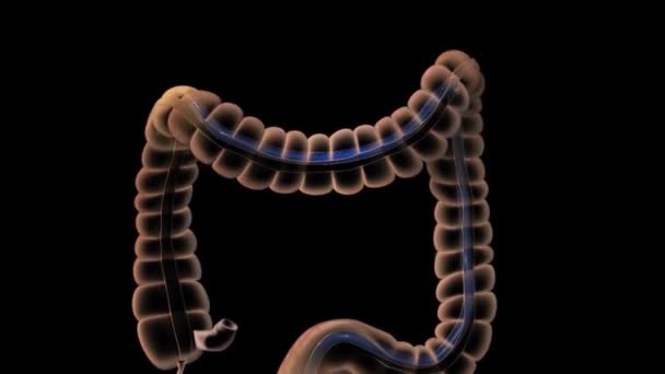 Sistema digestivo: colon sigmoide, colon descendente - Metraje, vídeo