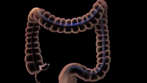 Пищеварительная система Сигмоидная толстая кишка, нисходящая толстая кишка - Кадры, видео