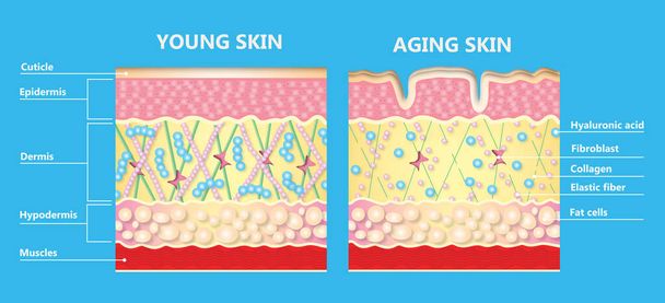 Genç cilt ve yaşlanan cildin diyagramı kolajenin azaldığını ve yaşlı deride kırık elastin olduğunu gösteriyor. Simge Vektörü İllüstrasyonu - Vektör, Görsel
