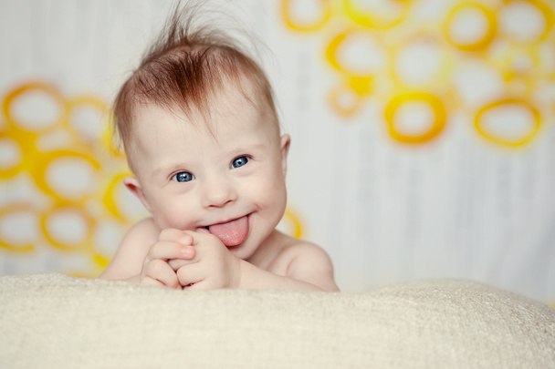陽気な小さな女の赤ちゃんダウンズ症候群 - 写真・画像