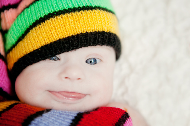 kleine baby in hoed gnome met Downs syndroom - Foto, afbeelding