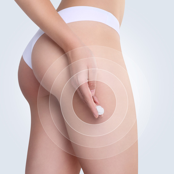 Frau Anwendung kosmetischer Creme von Cellulite auf das Gesäß in - Foto, Bild