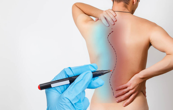 Doctor plastic surgeon marks with a felt-tip pen a marker for a surgical operation to remove fat on the abdomen of a girl. The concept of the modern procedure in plastic surgery abdominoplasty - Photo, Image