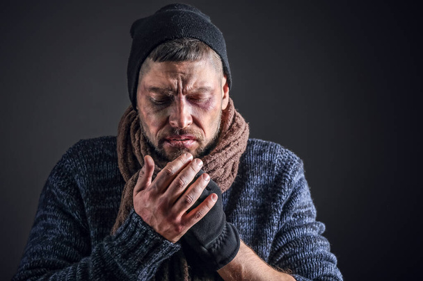 Portrait of poor homeless man on dark background - Photo, Image