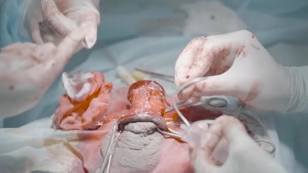 opération de l'organe mâle. action. gros plan sur l'opération du pénis. chirurgiens opèrent sur l'organe génital masculin pour le traitement ou l'élargissement - Séquence, vidéo