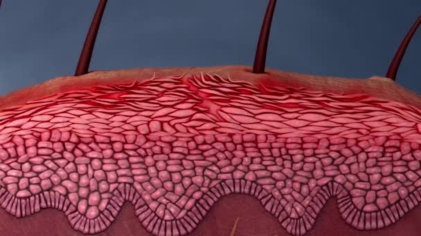 空中細菌は皮膚の傷を攻撃する - 映像、動画