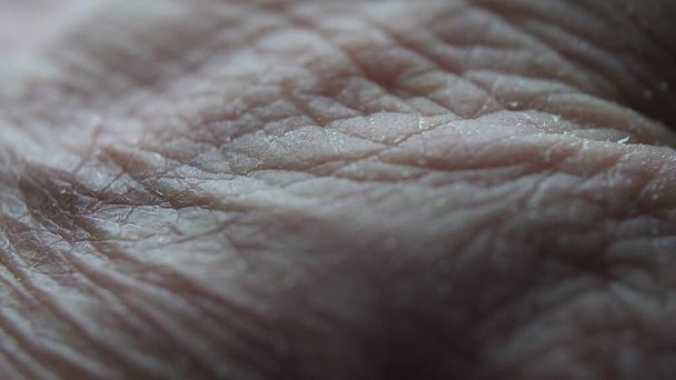 Gros plan des mains de personnes âgées atteintes de la maladie d'Alzheimer - Photo, image