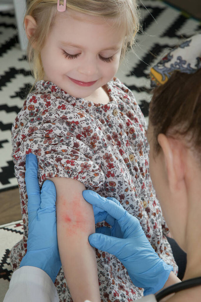 Доктор смотрит на красную и зудящую экзему на руке маленькой девочки. Девочка Тоддлера страдает атопическим дерматитом. - Фото, изображение