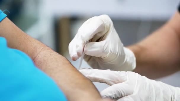 Κοντινό πλάνο ανώνυμος γιατρός σε γάντια λατέξ εισάγοντας βελόνα στο βραχίονα του ασθενούς κατά τη διάρκεια θεραπείας βελονισμού στην κλινική - Πλάνα, βίντεο