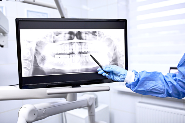 Image of doctor or dentist presenting with tooth x-ray film recommend patient in the treatment of dental and dentistry, working at workplace. - Photo, Image