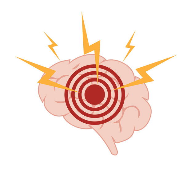  Das Konzept von Kopfschmerzen und Migräne. Eine Silhouette des menschlichen Gehirns mit Schmerzortung. Gehirnerkrankungen. Vektorillustration - Vektor, Bild