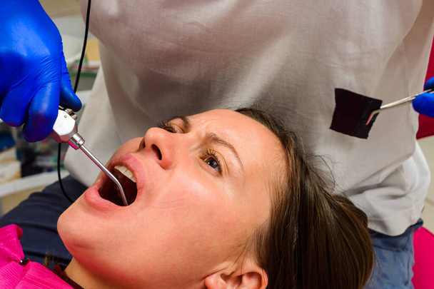 A fogorvos vízzel mossa a fogkezelés helyét, lemossa a vért és a fogtörmeléket.2020 - Fotó, kép