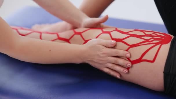 Primer plano de la pierna de un paciente con cinta adhesiva. Tratamiento del dolor. Deporte y rehabilitación. Pierna femenina con cinta de kinesiología - Imágenes, Vídeo