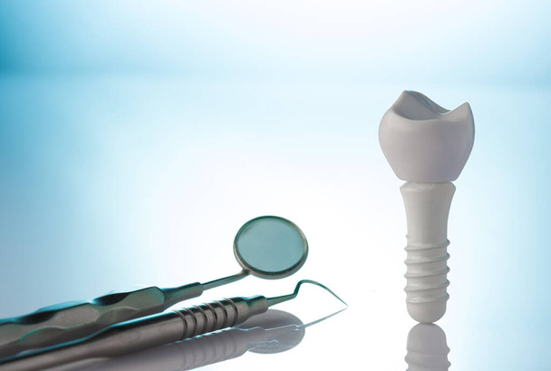 Implanty dentystyczne i przyrządy dentystyczne - Zdjęcie, obraz