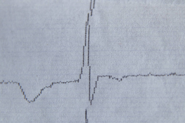 kardiogram na starém papíru jako pozadí makro fotografie - Fotografie, Obrázek