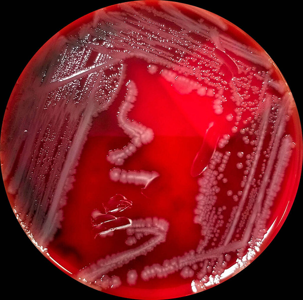 Placa de cultivo de agar con colonias de Salmonella - Foto, Imagen