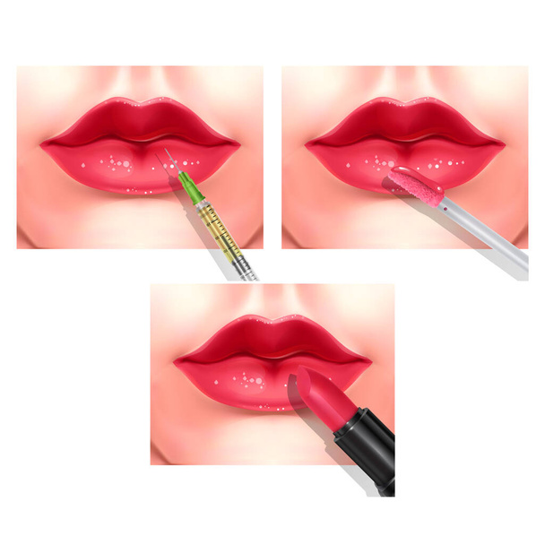 Υαλουρονικό οξύ πλήρωσης ένεση ή διαδικασίες μεσοθεραπείας. Όμορφα κόκκινα γυναικεία χείλη. Διανυσματική τέχνη - Διάνυσμα, εικόνα
