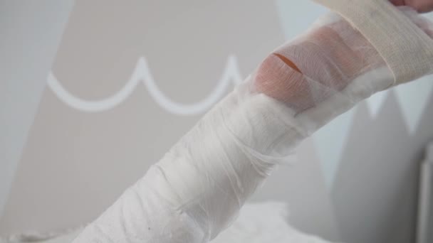 Gros plan sur le pansement de la langette en plâtre après la chirurgie pour coudre le tendon d'Achille - Séquence, vidéo