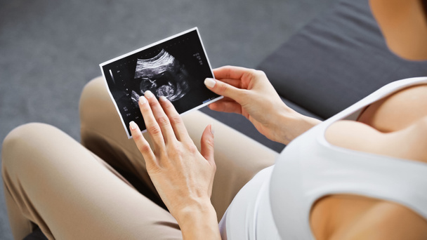 καλλιεργημένη άποψη της εγκύου γυναίκα κρατώντας υπερηχογράφημα σε θολή πρώτο πλάνο - Φωτογραφία, εικόνα