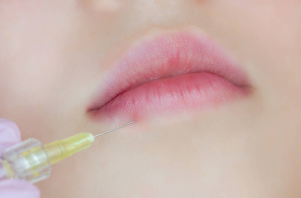 Der Arzt Kosmetologe macht Lippenvergrößerung Prozedur einer schönen Frau in einem Schönheitssalon. Kosmetologie Hautpflege. - Foto, Bild