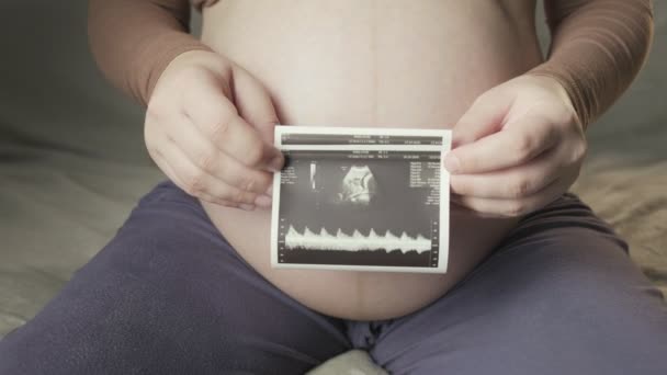 беременные руки живота и женщины держат изображение здорового нерожденного ребенка на УЗИ - Кадры, видео