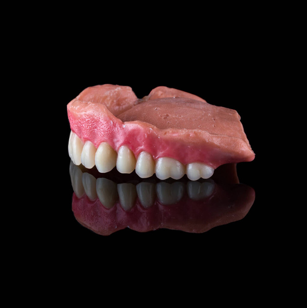 石膏モデルの上に逆さまに完全な上顎の入れ歯は、ワックスを閉じてギニバル輪郭を少し前のビューで閉じます。カラーA3 - 写真・画像