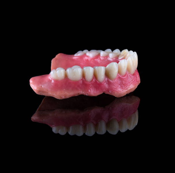Полная челюстная зубная протеза вверх ногами на штукатурке модели Wax Up и Gingival Contouring в слегка переднем обзоре с отражением. Цвет A3 - Фото, изображение