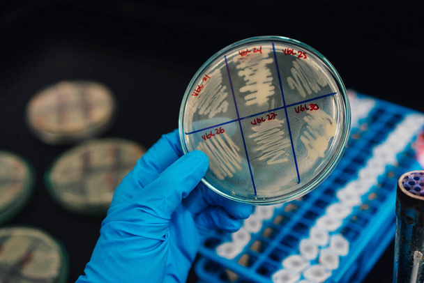 青い手袋を身に着けている科学者は、研究室でペトリ皿を手に持っている。科学者たちは細菌実験の結果を分析しています. - 写真・画像