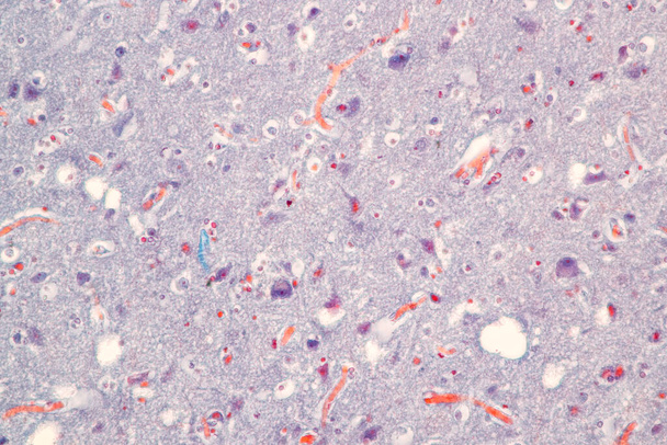 Laboratuvarda mikroskop altında Eğitim Omuriliği, Sinir, Beyincik, Korteks ve Motor Nöron İnsanı. - Fotoğraf, Görsel