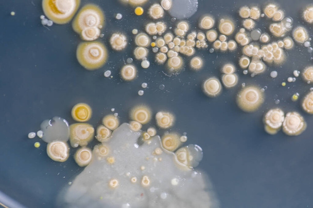 Mold Beautiful, Colony of Characteristics of Fungus (Mold) in culture medium plate από εργαστηριακή μικροβιολογία. - Φωτογραφία, εικόνα