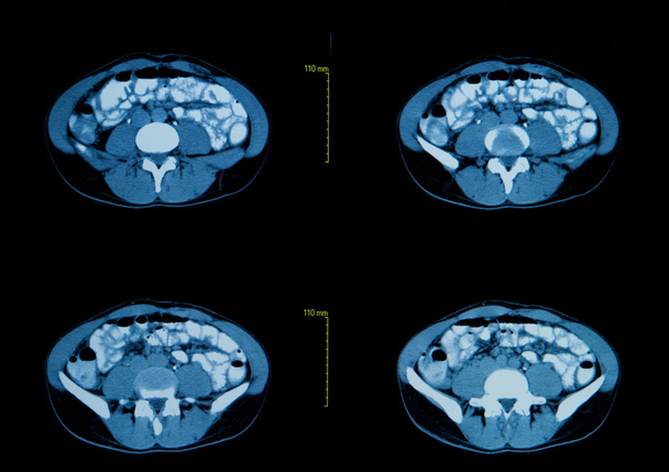 компьютерная томография грудной клетки. Медицинское образование
 - Фото, изображение