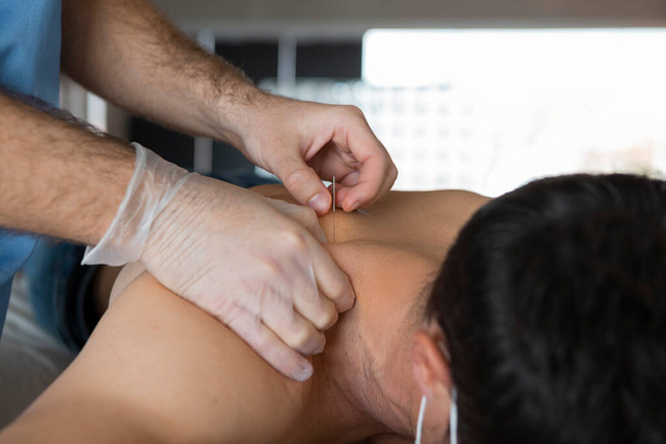 Egy félmeztelen férfi hátának közepe, aki száraz tűkezelést kap. Fizioterapeuta vagy orvos keze védőkesztyűvel tűt szúrt az akupunktúrás kezeléshez. - Fotó, kép