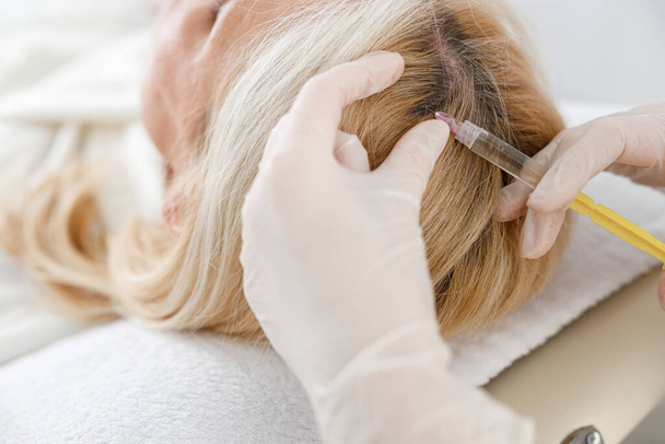 Косметолог проводит prp-терапию против выпадения волос пожилой блондинки в салоне красоты. Концепция косметологии - Фото, изображение