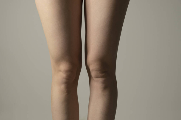 Fat legs and hips. Woman`s hips closeup raw studio shot in grey background. Dieting and fat loss concept. - Fotografie, Obrázek