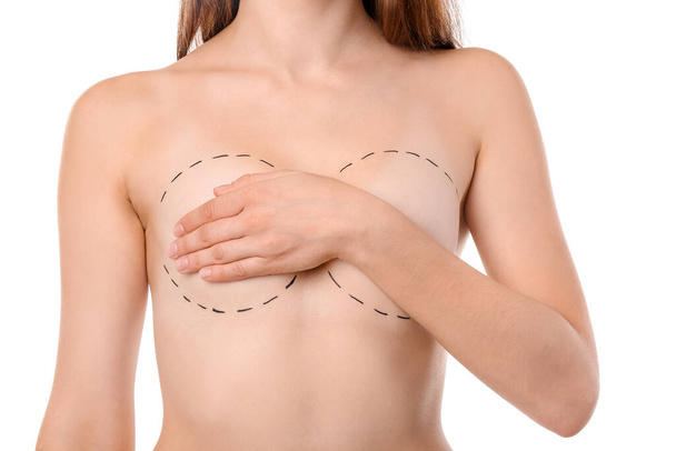 Mulher com marcas no peito contra fundo branco. Conceito de aumento da mama - Foto, Imagem