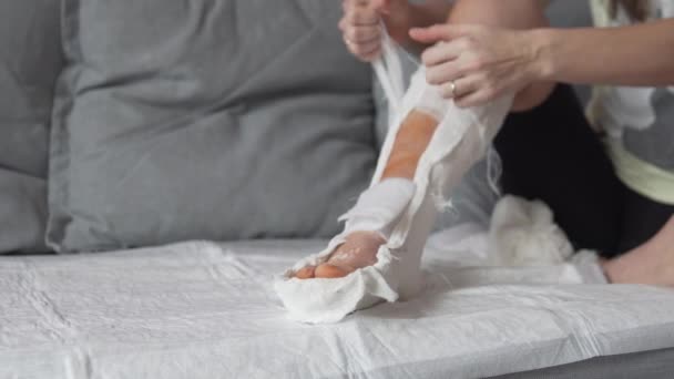  女性は包帯を削除し、呼吸する石膏で彼女の足を与えます. - 映像、動画