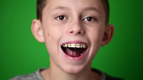 El muchacho sobre el fondo verde pone a la plancha para la alineación de los dientes delanteros superiores, la alineación de los dientes superiores. - Imágenes, Vídeo