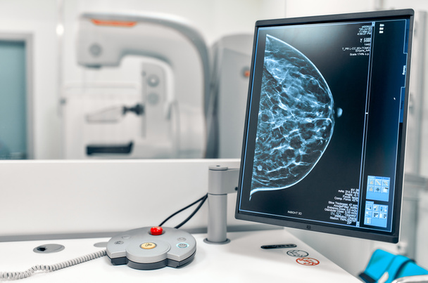 背景にマンモグラフィー検査を受けてモニター上の女性患者の胸のマンモグラムのスナップショット。病院でのマンモグラフィー検査。医療機器. - 写真・画像