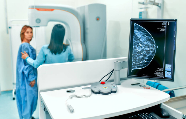 Снимок маммограммы груди пациентки на мониторе с маммографическим тестом на заднем плане. Маммографический тест в больнице. Медицинское оборудование. - Фото, изображение