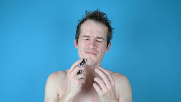 Retrato de un triste hombre descontento sobre fondo azul. Irritación de la piel después del afeitado en la piel del hombre. Foto de alta calidad - Foto, Imagen